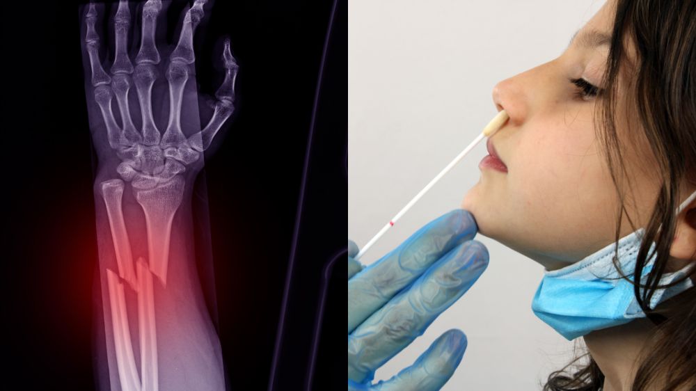 骨折のレントゲンとPCR検査の検体を採っている様子