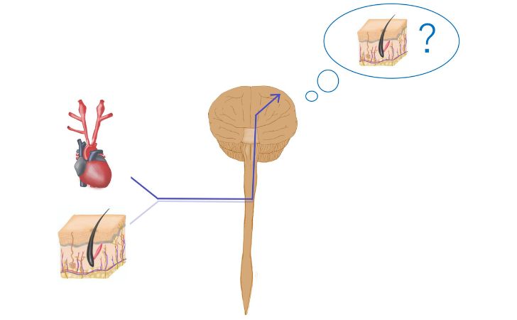 内臓関連痛の収束モデル