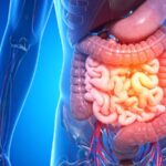 腸管と疾患のイメージ