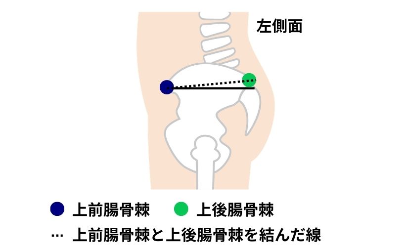 上前腸骨棘と上後腸骨棘の角度